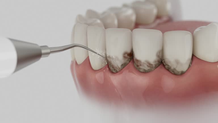 Trusted Dental Crowns And Bridges service in Gwinn, MI - Dentist Open Now